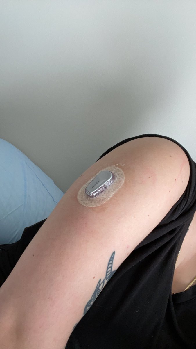 kaisapenguin's tweet photo. Finally got my dexcom back after 2 years 😭 https://t.co/7hcSMGfhy8
