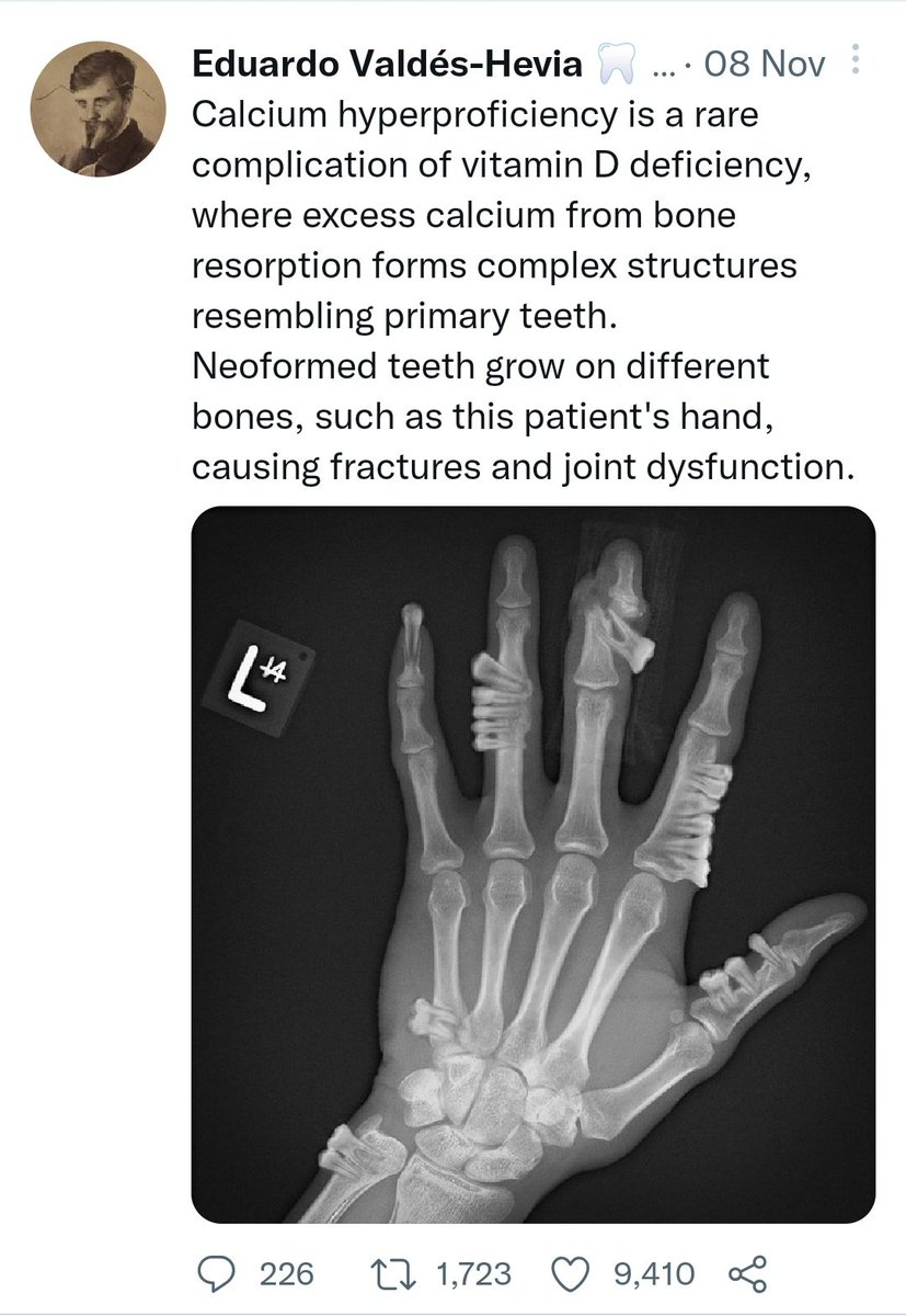 Artis ini bikin gambar-gambar seni manipulasi foto dengan Photoshop. Satu thema yang sering digarap, penyakit/patologi yang real, dengan gambar imajinatif yg horror.

Seru liatnya. Sila difollow atau dimasukkan ke list jika senang dg gaya seni spt ini. Keren. | <a href="/Valdevia_Art/">Eduardo Valdés-Hevia 👁️</a>