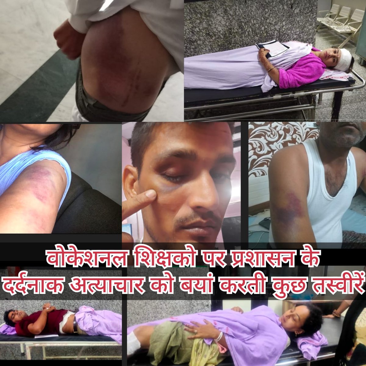 laxmankumar1234's tweet photo. हमारा हक खाकर लाठियां खिलाई है खट्टर सरकार यह कैसी रुसवाई है
#महाआंदोलन
#VTAHaryana 
#मनोहर_सरकार_वोकेशनल_टीचर्स_का_वादा_पूरा_करो
@BJP4Haryana
@mlkhattar
@cmohry
@chkanwarpal @PMOIndia
@PIB_India @HMOIndia @narendramodi https://t.co/lSBukY1Z9J