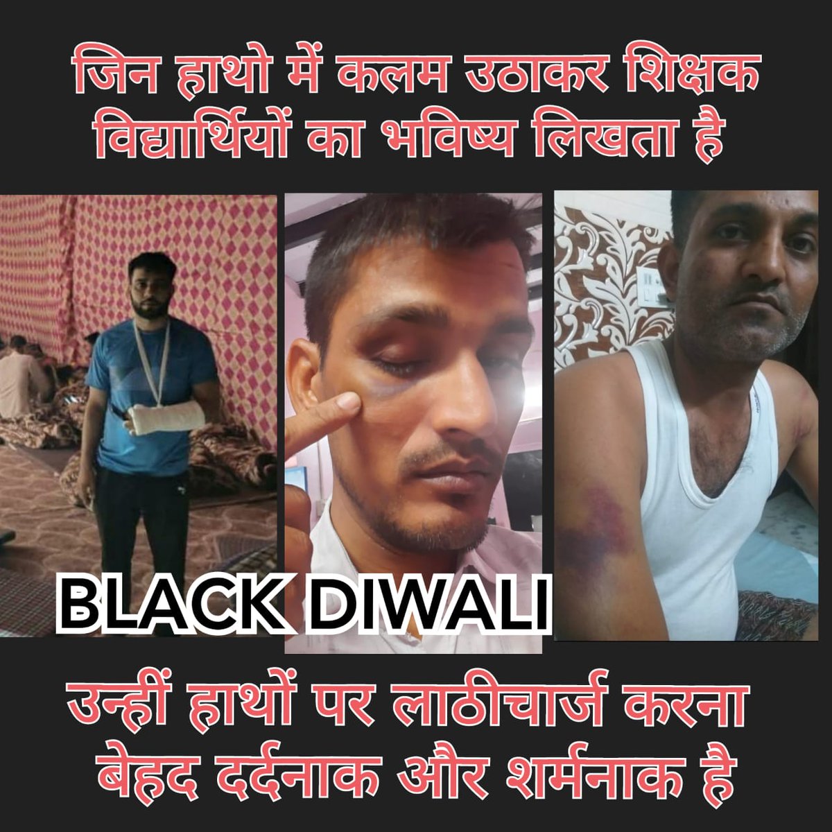 TorParveen's tweet photo. जो शिक्षक समाज निर्माण कर रहे हैं
उन्हीं को लाठियों का उपहार शर्मनाक
@mlkhattar @cmohry @BJP4Haryana @chkanwarpal @dpradhanbjp @PMOIndia
#महाआंदोलन
#VTAHaryana 
#मनोहर_सरकार_वोकेशनल_टीचर्स_का_वादा_पूरा_करो https://t.co/CnpQcotq7d https://t.co/YJrYvhuOgA