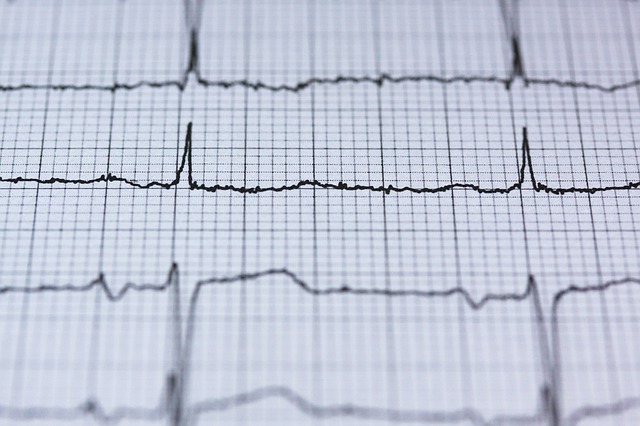 guiademayores's tweet photo. El #Ictus y la #InteligenciaArtificial #FibrilaciónAuricular #Arritmias #Cardiogramas - ONG Guía de mayores https://t.co/yaxjfI2zbd … … https://t.co/tXAqAuoOQs