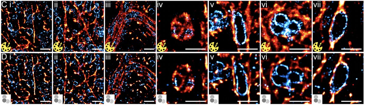 We employed the DeepSTORM NN developed by @ShechtmanLab and its implementation into the fantastic #ZeroCostDL4Mic platform @HenriquesLab @guijacquemet @LaineBioImaging to generate multi-color super-res images. Big thanks to @miCHRIScopy and Elias Nehme (Shechtman Lab) for help!