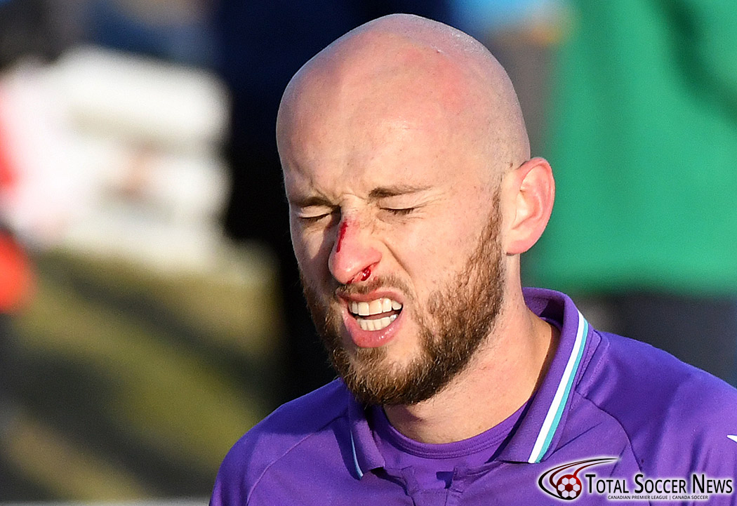 StuartGradon's tweet photo. Cause and effect.

Pacific FC's Jordan Haynes takes an elbow to the nose from Karifa Yao during the Canadian Premier League semifinal versus Cavalry FC Saturday.

More match photos: https://t.co/9EUlHJY6R7

#CanPL #CanPLPlayoffs https://t.co/idz3MOthZO
