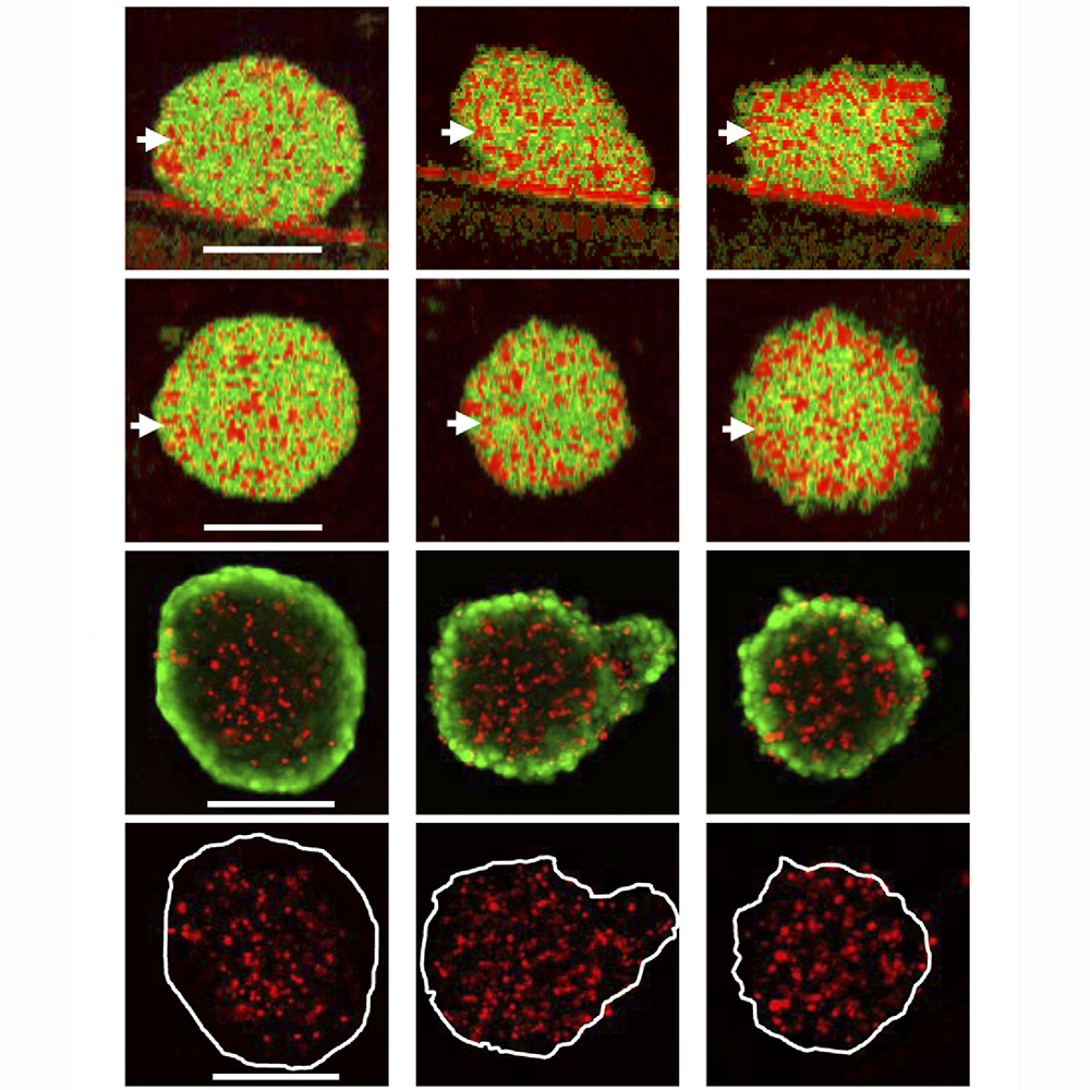 OpticaPubsGroup's tweet photo. Via #OPG_BOEx: Three-dimensional dynamics optical coherence tomography for tumor spheroid evaluation https://t.co/jPHkIrMwlH #OCT #TissueDynamics @UofTsukuba https://t.co/2eF6TsUN9e