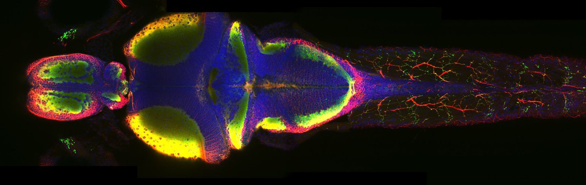 Zebrafish Rock! (@zebrafishrock) on Twitter photo Microscopy image of an entire juvenile #zebrafish. Credit to Bram Serneels & <a href="/yaksi_emre/">Emre Yaksi</a>. #ZebrafishZunday Microscopy image of an entire juvenile #zebrafish. Credit to Bram Serneels & <a href="/yaksi_emre/">Emre Yaksi</a>. #ZebrafishZunday