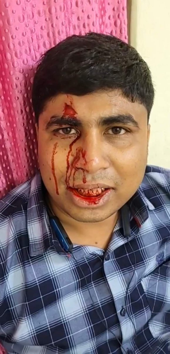 Nilonjit4AITC's tweet photo. .@BjpBiplab will break his waist by slipping on this innocent blood, he will not be able to stand up.

#ResignBiplabDeb
#TripuraPoliceGundaraj https://t.co/RkjajiwDSZ
