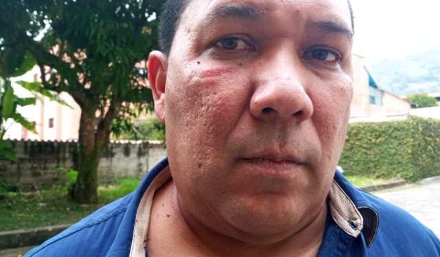 Sol651's tweet photo. ¿QUE ESPERABAN? #EleccionesEnTirania #21Nov Por reclamar irregularidades en el centro electoral ubicado en el Colegio Franciscano ubicado en El Arenal, Mcipio Libertador Edo #Merida, Militares y Colectivos  golpearon a Luis Millán, representante de la MUD https://t.co/KX7an6kJzA