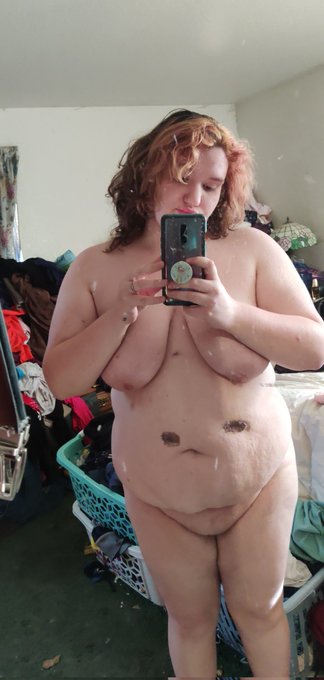 Still recovering but the weight is coming off! Already down 30 pounds https://t.co/LrNqdxOR3I