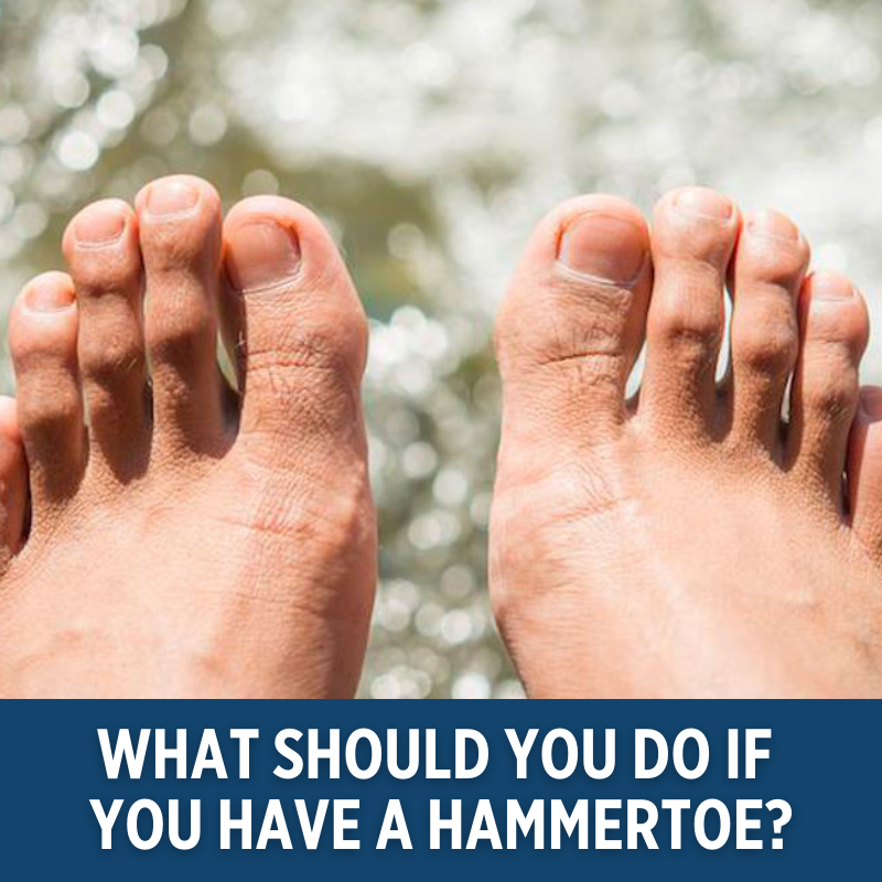 River_Podiatry's tweet photo. Click the link below to learn more. #RiverPodiatry

https://t.co/mzAcQcPheS https://t.co/PIafPnS63I