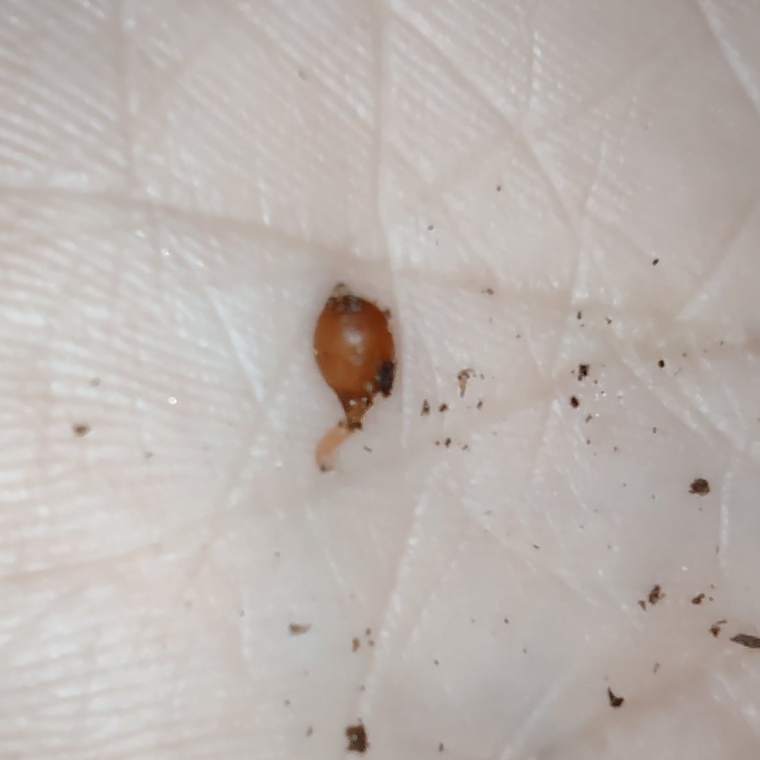 succincrazy's tweet photo. Have you ever seen an earthworm hatch??? Welcome to the world my little composting friend ๐ชฑ๐ #vermicomposting #redwiggler #europeannightcrawler https://t.co/Zgjeg2YUMC
