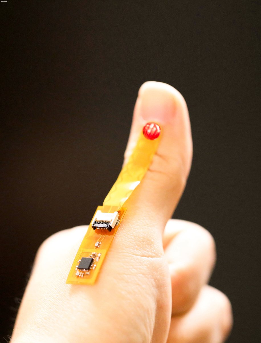 ScienceMagazine's tweet photo. Scientists in @ScienceAdvances have developed a wearable DNA hydrogel-based sensor that detects bacterial infections in wounds even before visible signs are present. https://t.co/kQjuRfEtgt https://t.co/Ge7W6NE6Zx