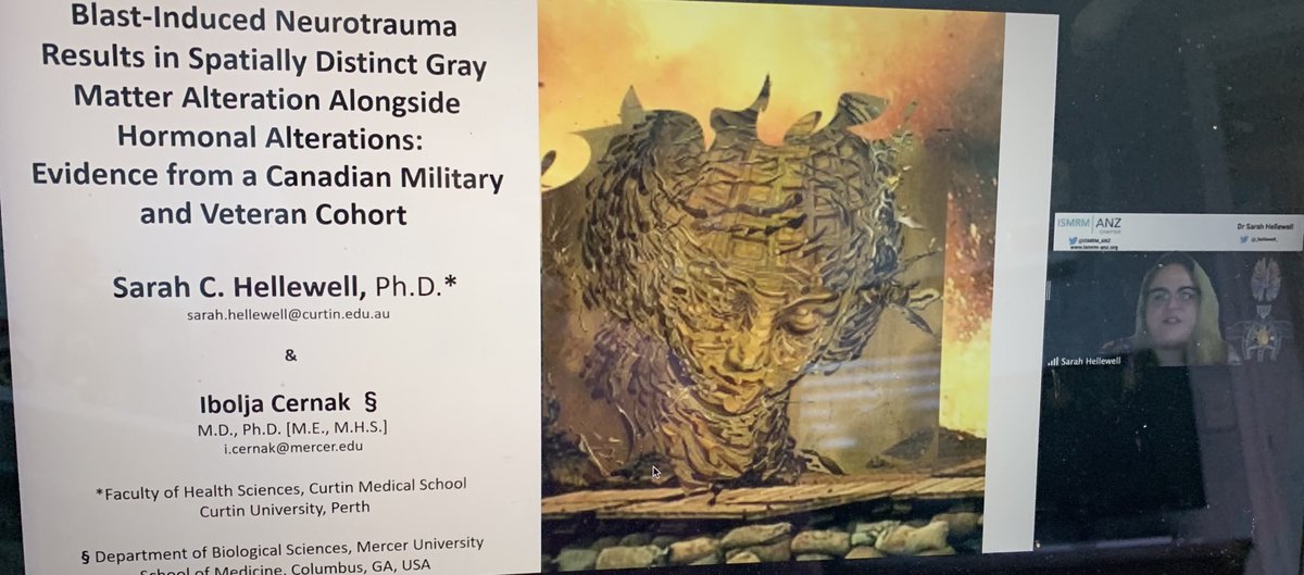 stadimal's tweet photo. Learn more about blast-induced trauma from Dr Sarah Hellewell at the ⁦@ISMRM_ANZ⁩ annual meeting! https://t.co/zGymnLJUsF