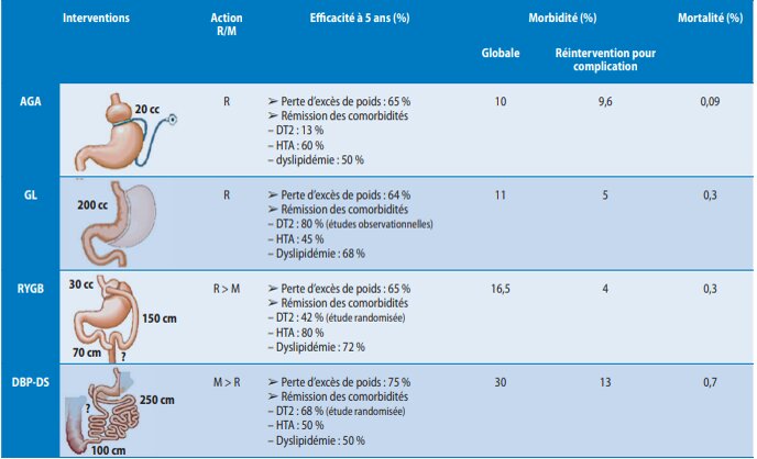 hau_sss's tweet photo. 13/n
Les moyens pharmaco sont limités et même s’ils adoptent la pratique de l’#exercice_physique, les articulations ne parviennent pas à supporter leurs poids. Pour cela, la #chirurgie_bariatrique a prouvé son efficacité pour entraîner une perte de poids importante 
#weightloss https://t.co/XDIJvN4QkN