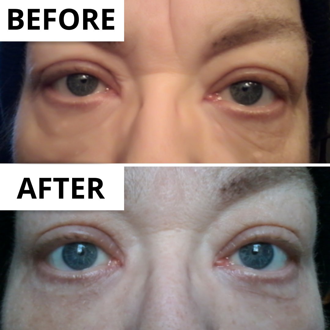 Plexaderm tweet media