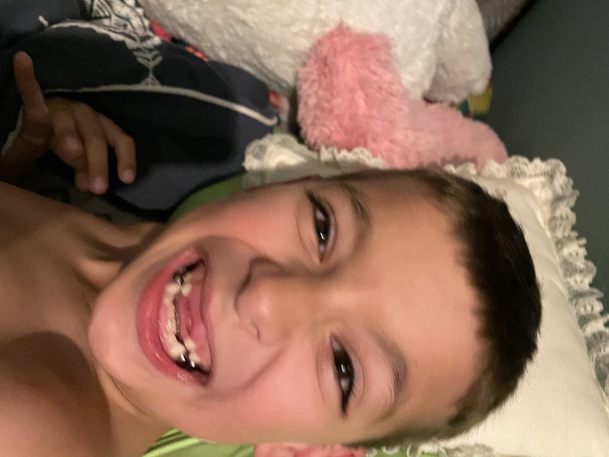 Megan_Watson55's tweet image. In 24 hours my tiny human has lost his  two front teeth! Cue the music: “All I want for Christmas is my two front teeth!” Tooth fairy has been super busy at our house!!!! #toothfairy #twofrontteeth #boymom #myboy #tooth