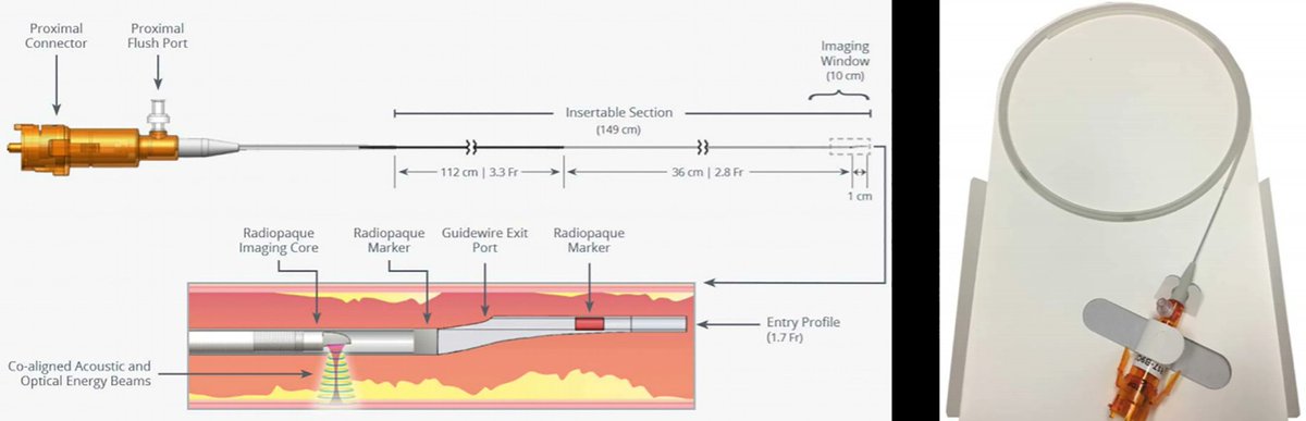 First-in-Human!

Novel dual-techlology #IVUS + #OCT co-registration intracoronary catheter.  17 patient feasibility study.

onlinelibrary.wiley.com/doi/full/10.10…

x.com/CCIJoural, facebook.com/CCIJournal, instagram.com/CCIJournal