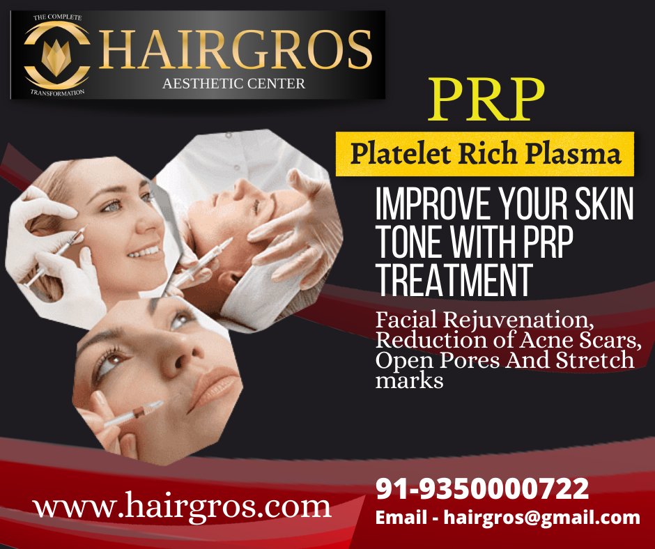 PRP therapy is a treatment in which platelet-rich plasma is injected into the tissues to help the body recover from injuries, including surgical procedures.
Contact at  +91-9350000722 
#hairtransplant #hairgros #prp #prpskin  #skincare
#haircare #aftertransplant