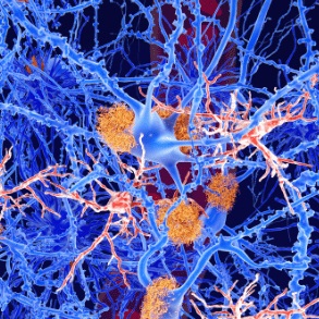 AlzheimerEurope's tweet photo. .@biogen and @EisaiUS have presented new data on #lecanemab- their investigational antibody targeting #amyloidbeta for the treatment of #Alzheimer's disease- at #CTAD21
https://t.co/WtMKNCg6rX https://t.co/Tk8gyTyWfK