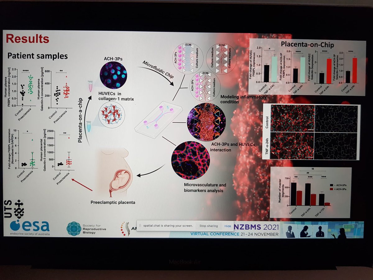 McClementsLana's tweet photo. Check out my PhD student’s (Sahar Ghorbanpour) poster number 556 placenta-on-a-chip model to study #preeclampsia #placenta #FKBPL #Gal-3 @ESASRB @ReproductionSRB @UTS_Science @UTSFEIT https://t.co/sMHpRRWPRM
