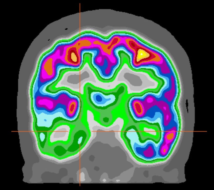 RadioNuclear Podcast tweet media