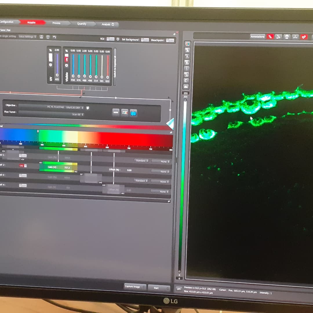 PiescheLab's tweet photo. Introduction course for our new #confocal including #lifeimaging. Looking forward to see #macrophages eating #cancer cells for a new #immunotherapy approach. #leica #Stellaris #fondequiq https://t.co/X0brMhoqA7