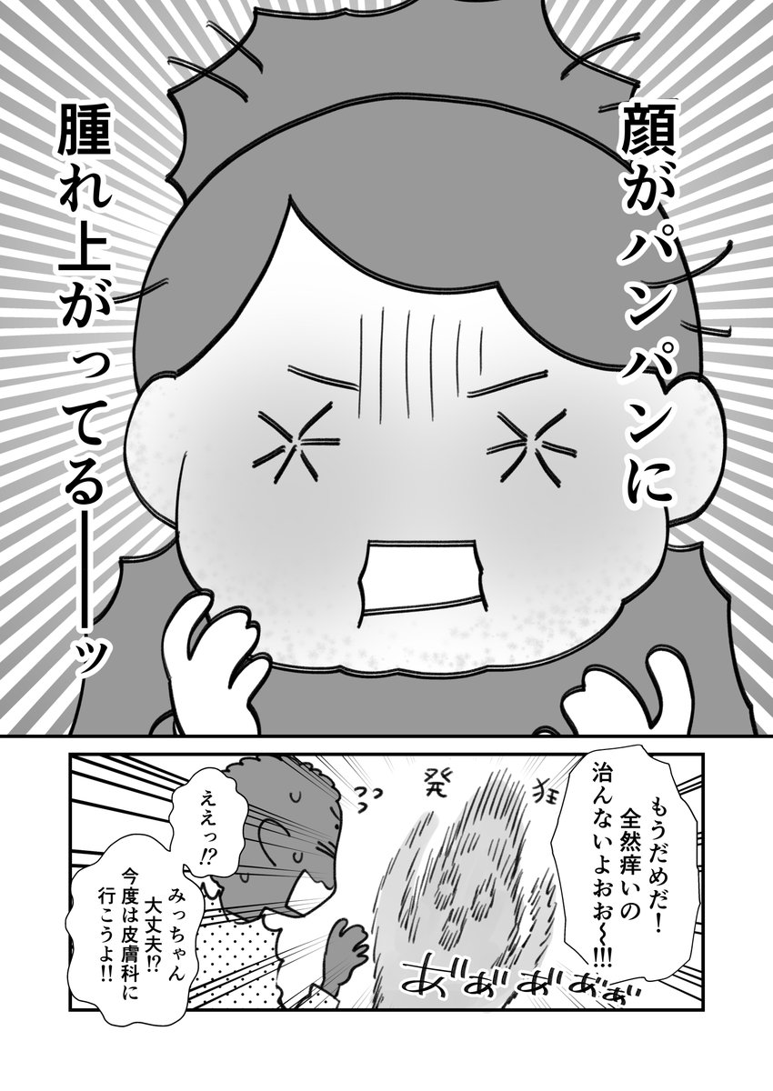 異種族妊娠したら全身かゆくなったレポ② 