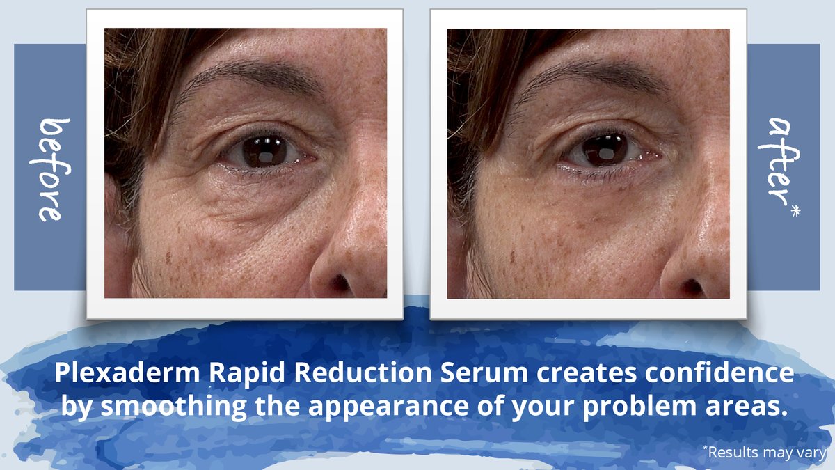 Plexaderm tweet media