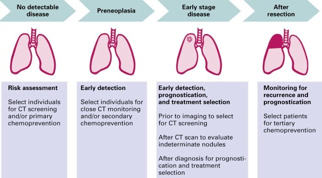 This is the last week of Lung Cancer Awareness Month! Our final facts for this month are about lung cancer survivors.  Early detection can be done using a low dose CT scan and can decrease cancer mortality rates by 14-20% in high risk populations.