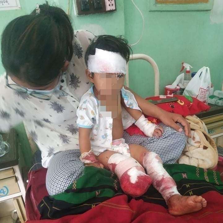She is only 2. 
 Such a lovely and cheerful kid. 

Now, I wanna hug her tight &amp; say even she lost her mom &amp; leg in such young age, she will grow strong and become a power woman.

Bcos we gonna get the justice &amp; do everything we can to give kids like her have peaceful lives.