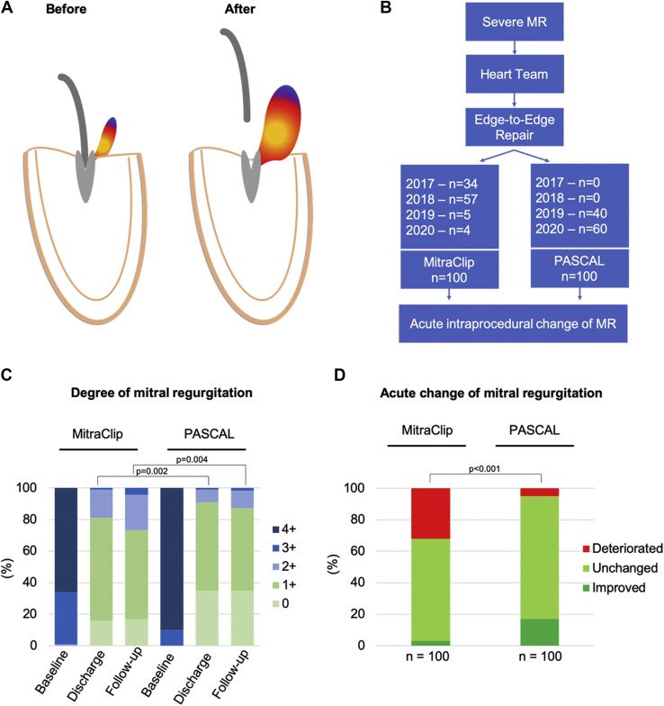 Peter Lüdike (@luedike) on Twitter photo Impact of Mitral Valve Repair Technologies on Predictability of Post-Delivery Residual Mitral Regurgitation
<a href="/DGK_org/">Deutsche Gesellschaft für Kardiologie</a> <a href="/escardio/">European Society of Cardiology</a> <a href="/AGIKinterv/">AGIK</a> <a href="/JACCJournals/">JACC Journals</a> <a href="/AHAMeetings/">AHAMeetings</a> Impact of Mitral Valve Repair Technologies on Predictability of Post-Delivery Residual Mitral Regurgitation
<a href="/DGK_org/">Deutsche Gesellschaft für Kardiologie</a> <a href="/escardio/">European Society of Cardiology</a> <a href="/AGIKinterv/">AGIK</a> <a href="/JACCJournals/">JACC Journals</a> <a href="/AHAMeetings/">AHAMeetings</a>