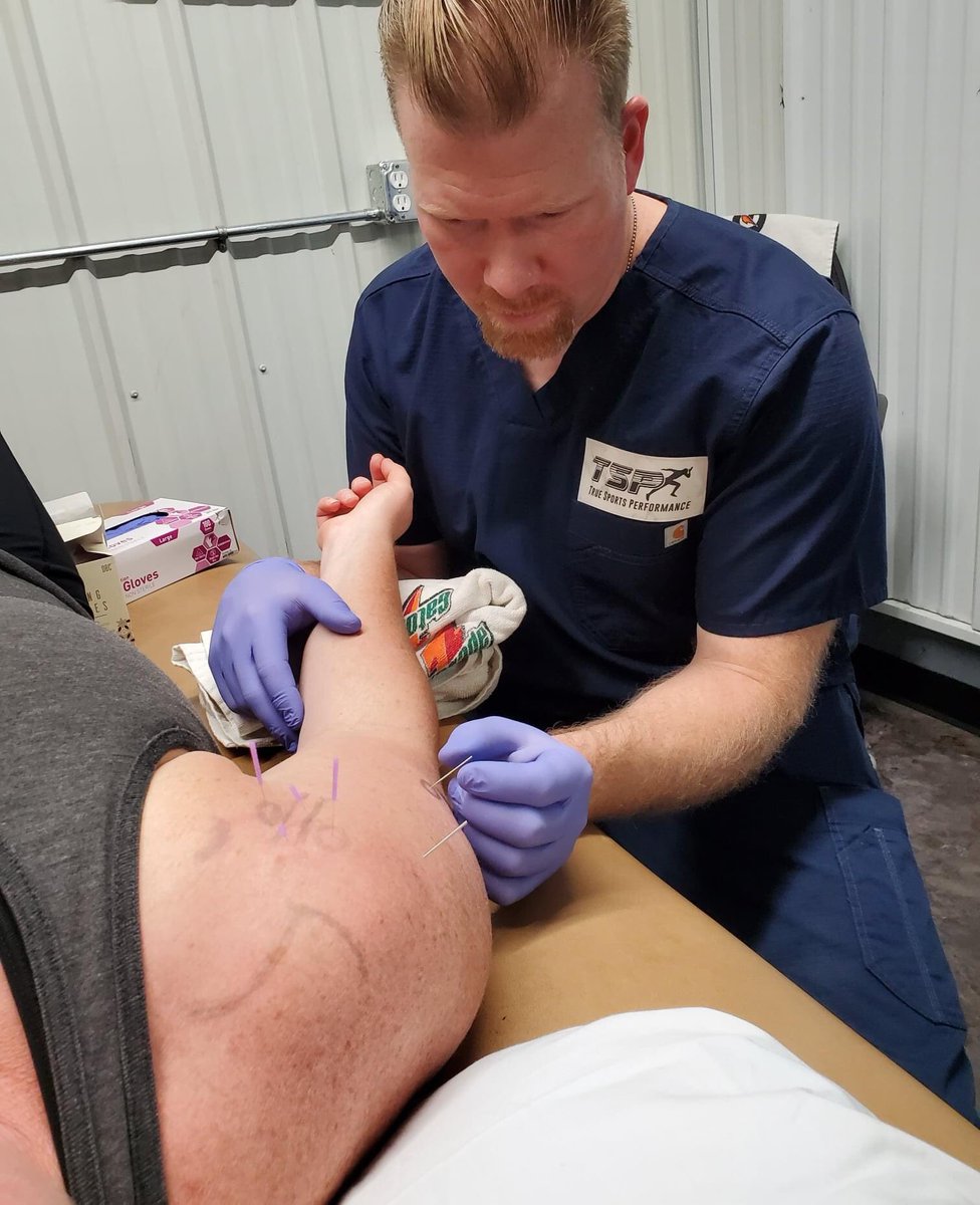 TrueSportsDL's tweet photo. Specialized Treatment options we offer at TSP:
-Dry Needling
-Deep Oscillation
-Graston Technique
-Cupping
We are your solution for SPORTS REHABILITATION.
Schedule an appointment at:
https://t.co/2zd3uhYTd6
#dryneedling #deeposcillation #GrastonTechnique #cupping https://t.co/JKUNAqoVUR