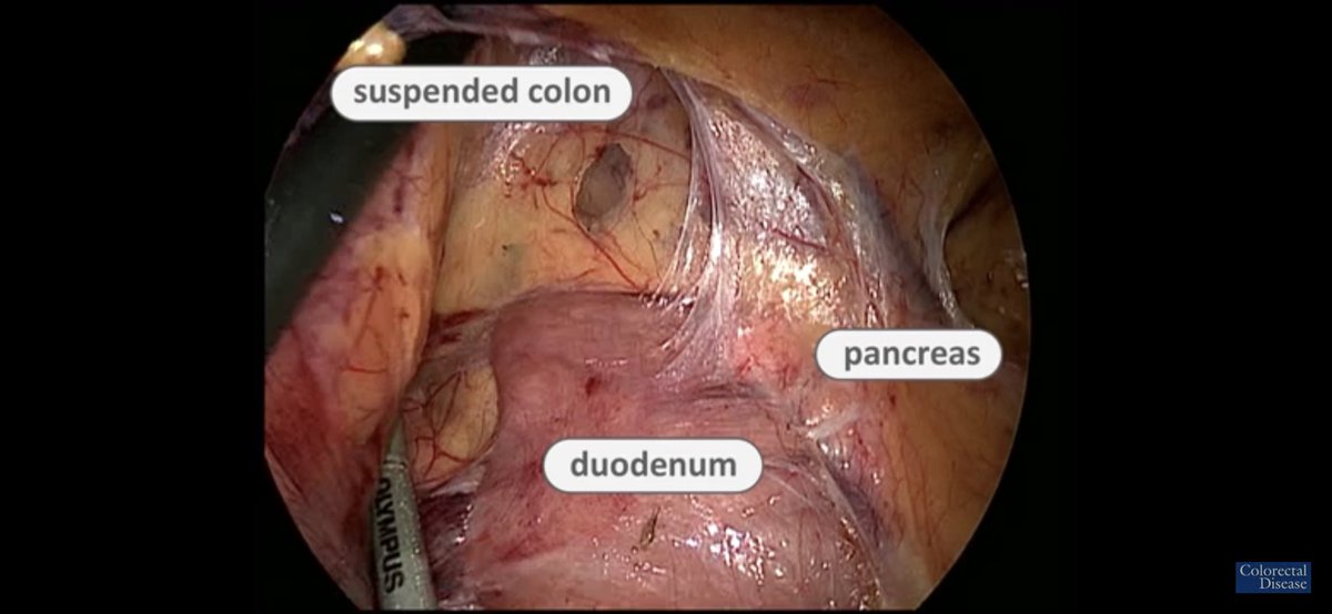 Colorectal Disease tweet media