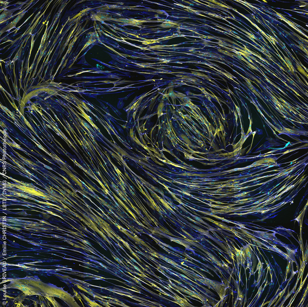 #LPPI 📷 | ❋ Van Gogh cellulaire ❋ Lorsque des cellules précurseurs du muscle fusionnent, elles ont la particularité de former ces structures nébuleuses, évoquant sans conteste La Nuit étoilée du peintre Van Gogh. Dans ces tourbillons microscopiques, … instagr.am/p/CXF41mhsoZN/