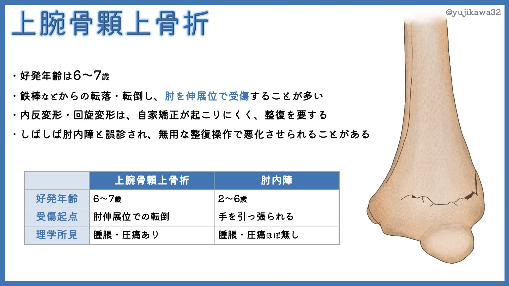 肘内障 Twitter Search Twitter