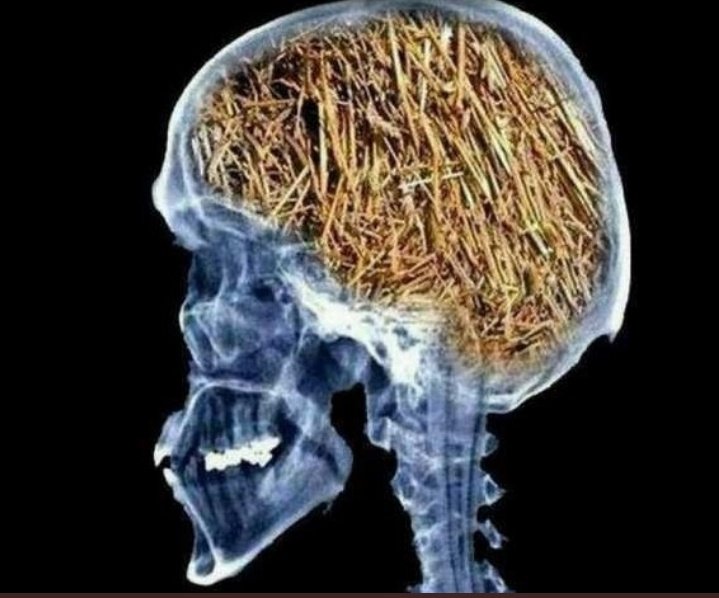 Fatima_Shahh__'s tweet photo. Dear bestie your brain's X-ray test results are here👉🏻👈🏻 https://t.co/CWNPBTgjQi