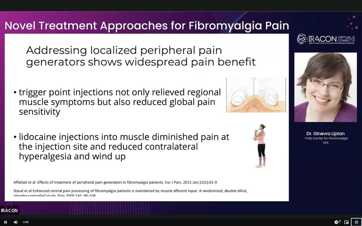 #IRACON21 #IRACON2021 
Novel treatment Approach in Fibromyalgia by Ginevra Liptan
👉🏻 Fibromyalgia is not a truly functional disorder ➡️ has a organic basis 
👉🏻 Microglia have increased metabolic activity ➡️ low dose Naltrexone might work (3-5mg)
@2021Iracon <a href="/IndianRheum/">IRA</a> <a href="/IJRheum/">Indian Journal Of Rheumatology</a>