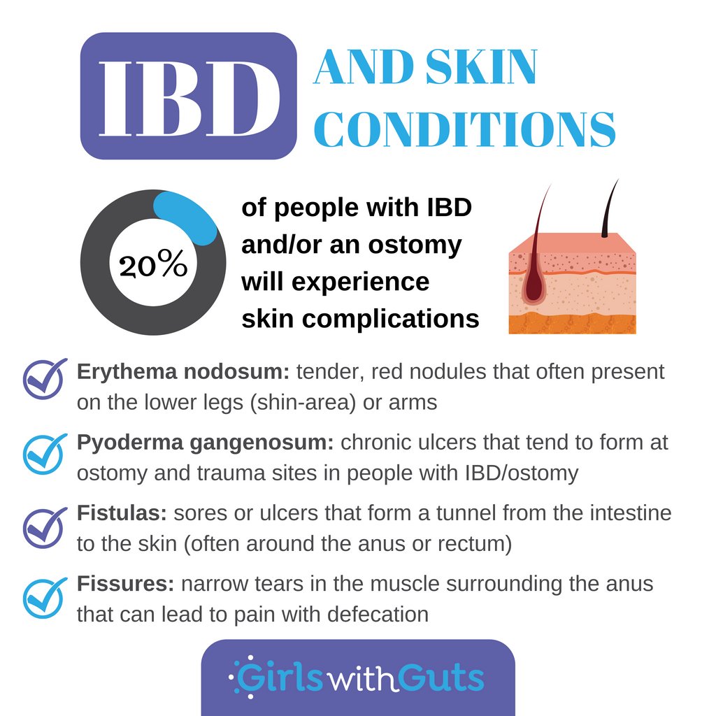IBDgirls's tweet image. IBD is much more than a bowel disease. As part of IBD Awareness Week, we are sharing information about some of the extraintestinal manifestations that many of our GWGs experience. Today, we are focusing on skin conditions.

#crohnsdisease #ulcerativecolitis #CCAwarenessWeek