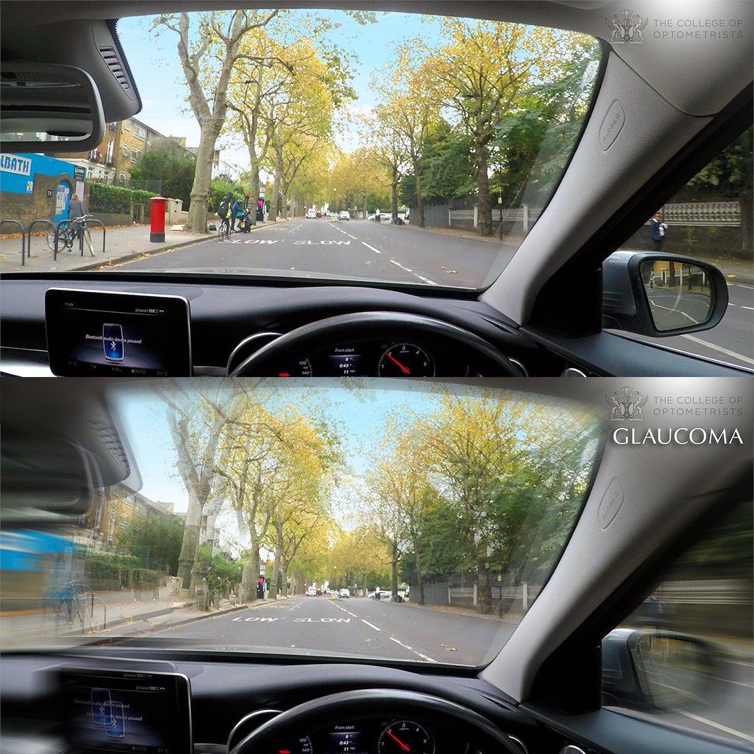 In our recent survey around a fifth of respondents said they had missed a turning because they were unable to see the sign.

We're running a campaign to highlight the importance of good vision when driving. Share our campaign assets ➡️ bit.ly/3DcQUGX
#WeAreOptometry