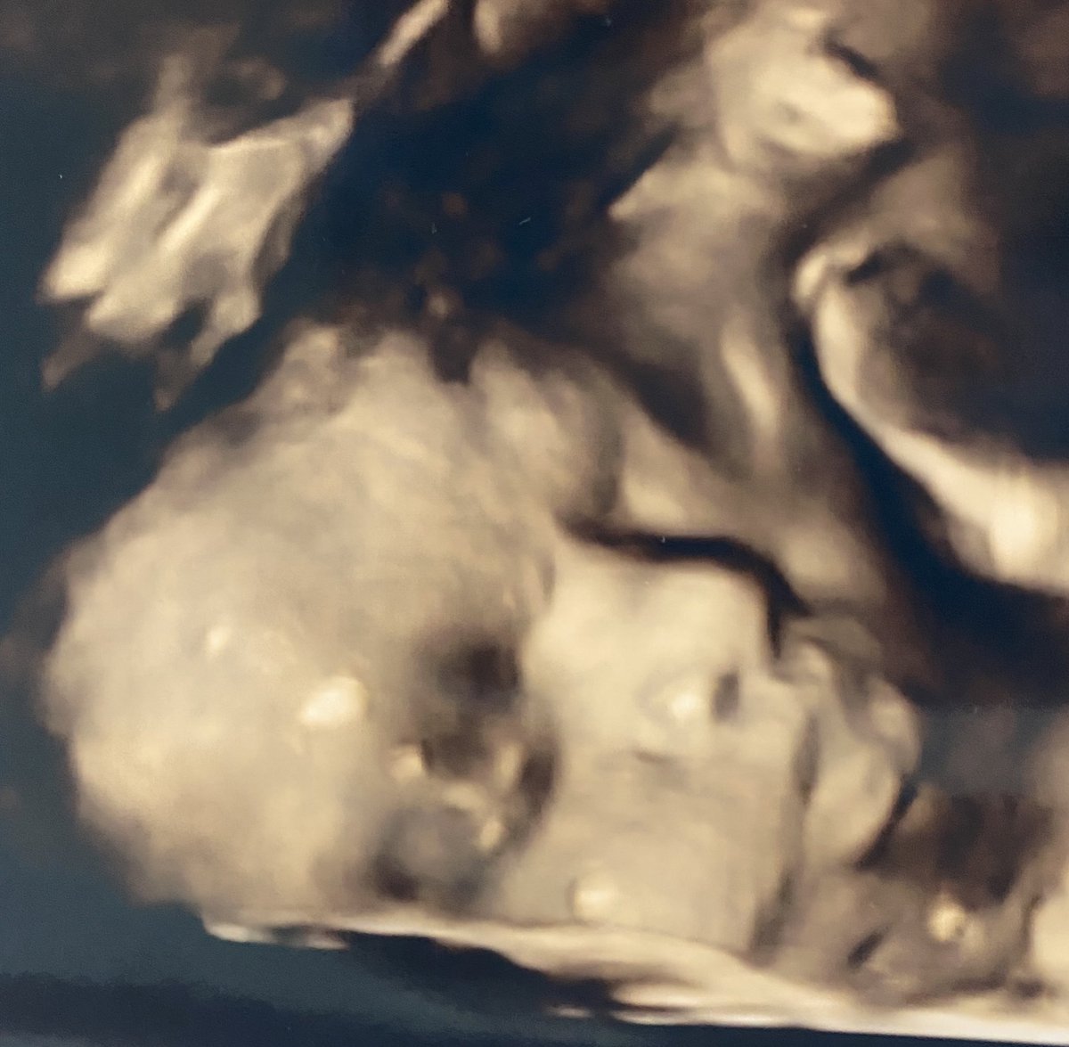 AndreaTupper's tweet photo. My most precious “Grand” daughter💓 #10moreweeks https://t.co/pnD2R1fWPn