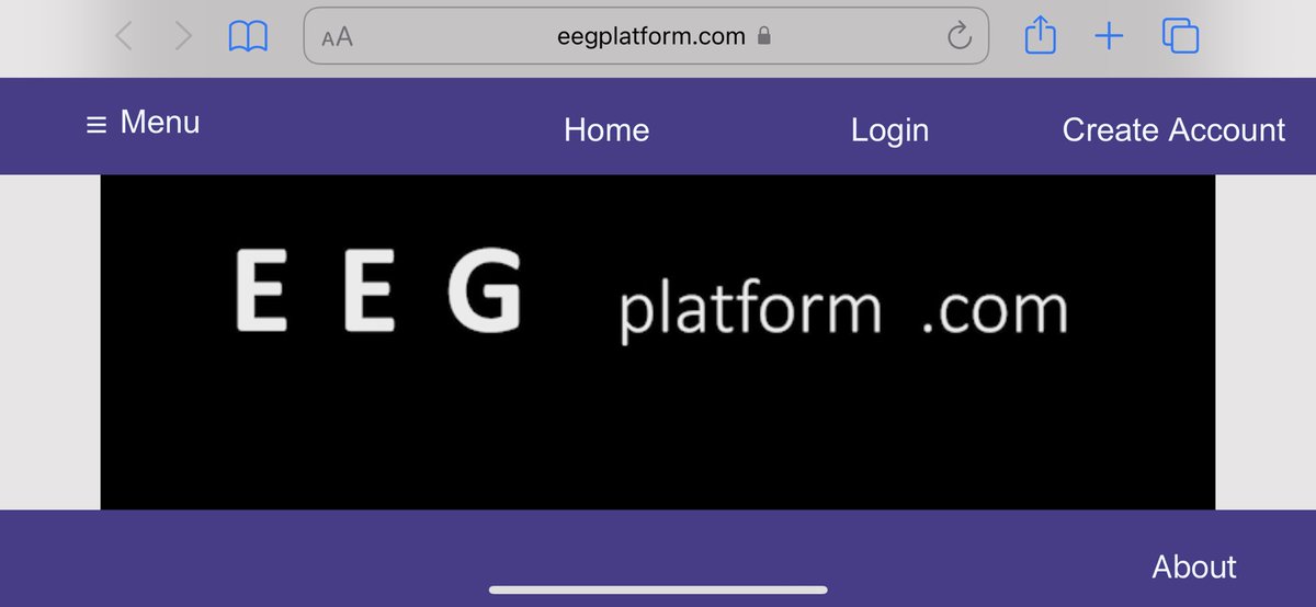 Chris Traner, MD (@cbtraner) on Twitter photo NEW TEACHING PLATFORM ALERT: hot off the presses - new teaching tool to learn EEG (eegplatform.com)! Fully interactive and we want to hear from you on how to make it better! <a href="/AmEpilepsySoc/">American Epilepsy Society</a> #AES2021 <a href="/yaleneuropd/">Jeremy Moeller</a> <a href="/AndresFdezMD/">Andres Fernandez</a> NEW TEACHING PLATFORM ALERT: hot off the presses - new teaching tool to learn EEG (eegplatform.com)! Fully interactive and we want to hear from you on how to make it better! <a href="/AmEpilepsySoc/">American Epilepsy Society</a> #AES2021 <a href="/yaleneuropd/">Jeremy Moeller</a> <a href="/AndresFdezMD/">Andres Fernandez</a>