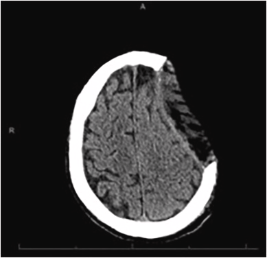 Otolaryngology Cases tweet media