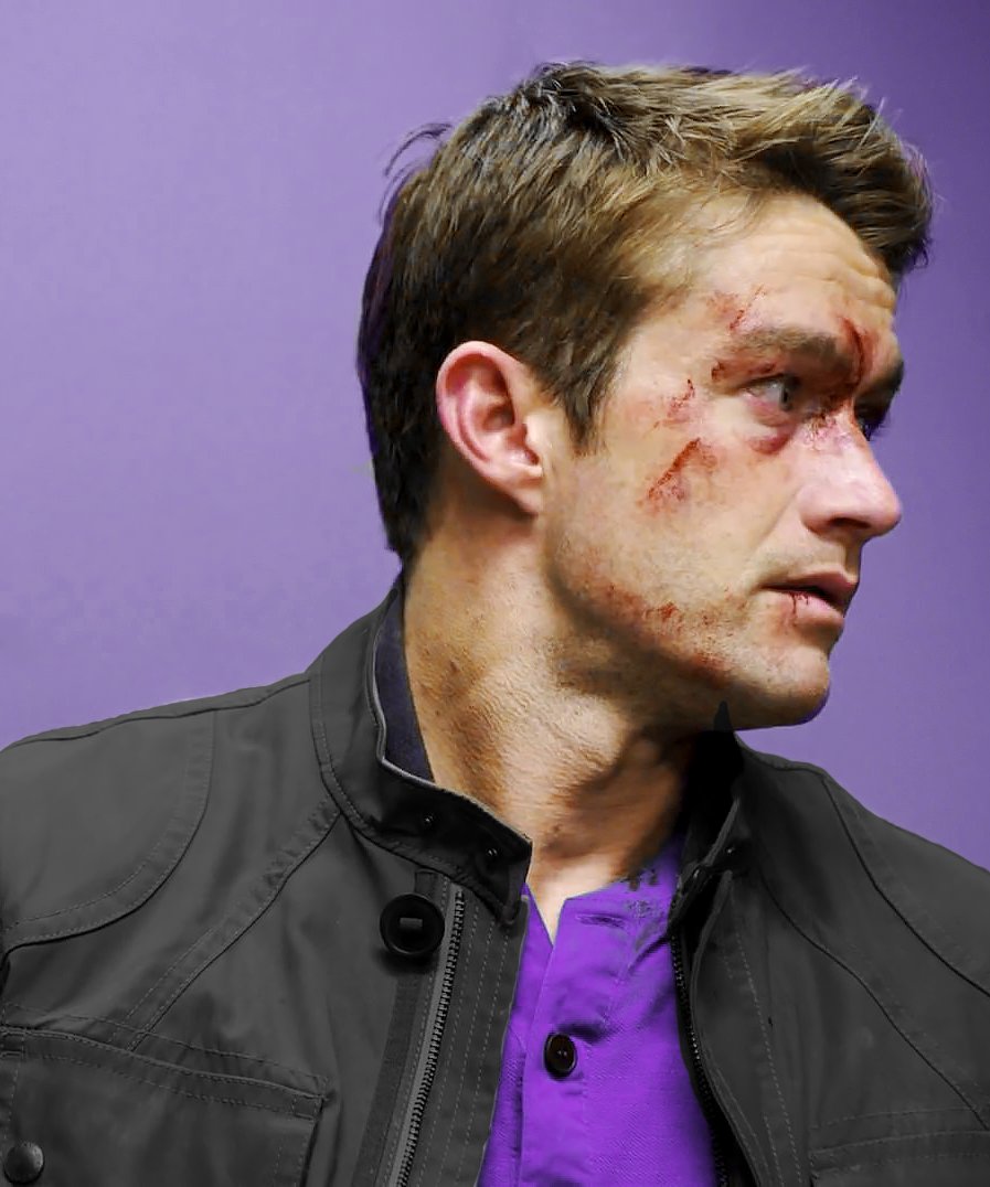 KEEPSHOOTlNG's tweet image. ⠀                                      ❝ ᴏᴋᴀʏ . . . ᴛʜɪs ʟᴏᴏᴋs ʙᴀᴅ. ❞

                                     𝐇𝐀𝐖𝐊𝐄𝐘𝐄 *// 𝐂𝐋𝐈𝐍𝐓 𝐁𝐀𝐑𝐓𝐎𝐍

                                                 ( written by #ᴄᴀʀᴀ )