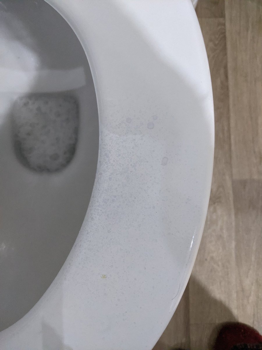 buryletewke's tweet photo. @AldiUK Your antibacterial spray has discoloured our toilet seat!! 🙈 https://t.co/hktODi2j6h