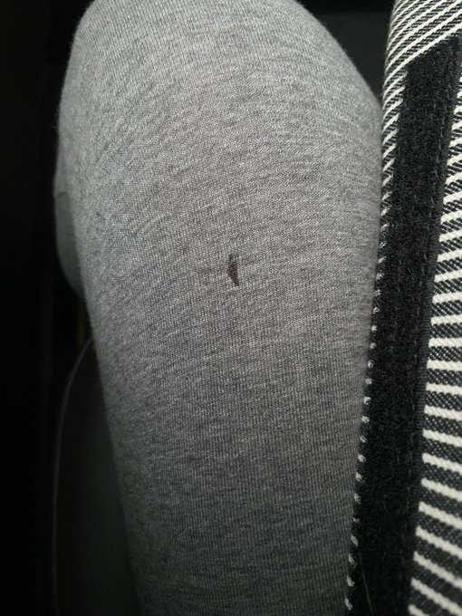 謎に缶バッジ入ってて、針がポッケ突き破ってて足にブッ刺さって出血🩸痛すぎ。どえらい声でた。 動物病院へ向かってる。 タクシーきたから履き替える余裕全くなかった。。。 https://t.co/n4kC<a href="/tag/%E5%8C%A0%E3%81%AE%E6%8A%80"class="tags"><span>#匠の技</span></a>