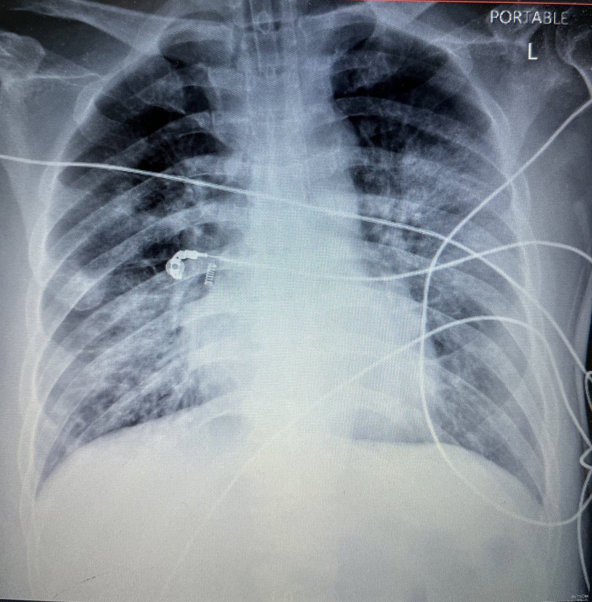 bitcoinmalaya's tweet photo. It seems like people start to take COVID19 lightly and even make jokes out of the pandemic.

-30K Malaysians died of COVID, as of today, at least.
-Our daily cases are still more than 4K cases.
-60K active cases. Remember COVID treatment can take weeks to recover. https://t.co/OFaAkQCV5C