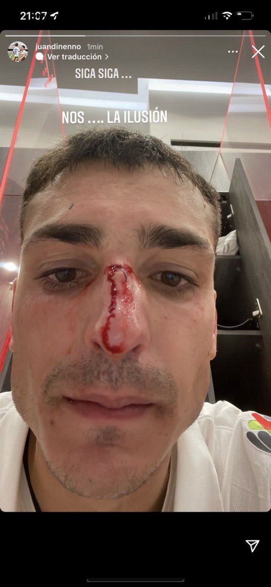 rikardocasares's tweet photo. Y al arbitro si te da miedo marcar un penal por la situación histórica del local no eres árbitro es un simple cobarde!!! https://t.co/6dj1kF7ZhY