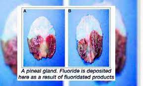 33_indigo's tweet photo. @LevyRincon @agmethescaf @DonIzquierdo_ @LupeMohawk agmeth déjate educar te gusta ser twittero aprende entonces por favor: El flúor produce daños en la glándula pineal puesto que se acumula en ella, produciendo una reducción de la melatonina, que es una hormona que producimos durante el sueño y que tiene efectos anticancerígenos. https://t.co/SE4jQQRI3Y