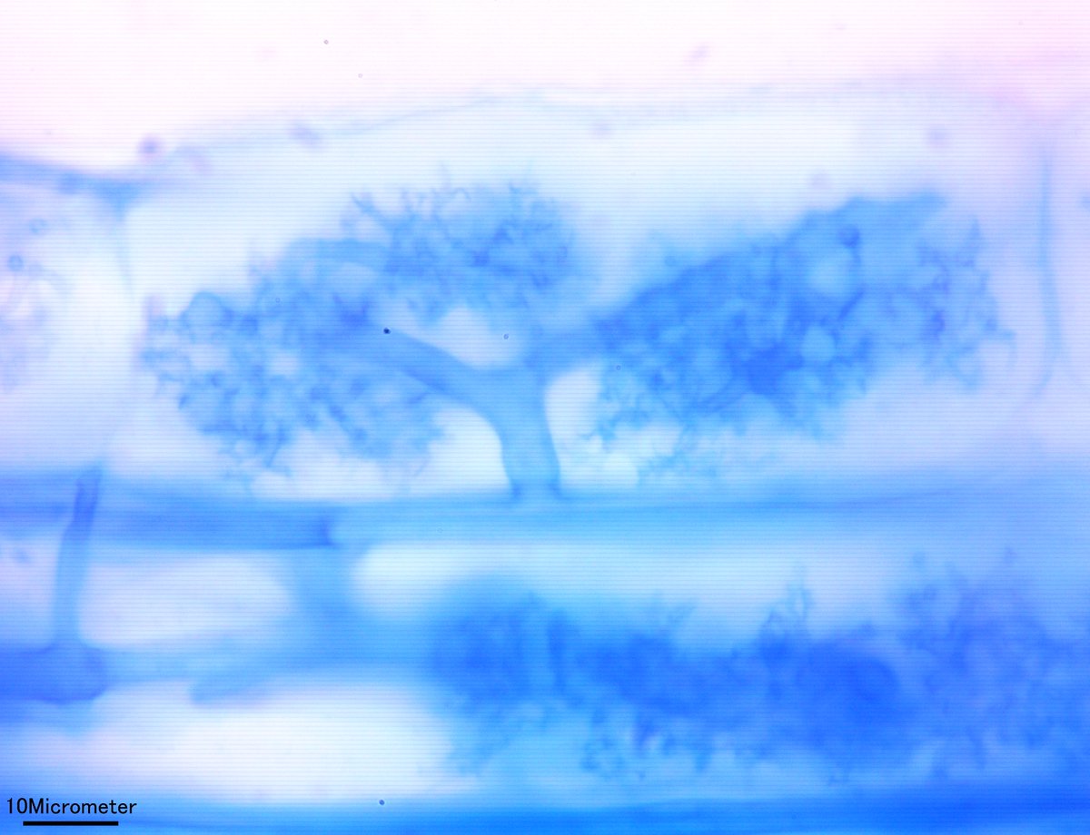 takeshi_sentoku's tweet photo. The arbuscule
#mycorrhiza #arbuscule #菌根菌 https://t.co/0udxSQEZ7o