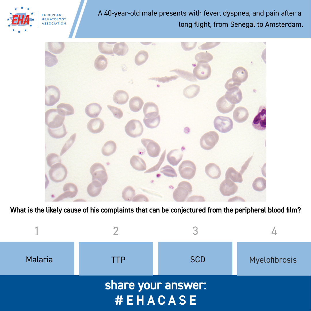 European Hematology Association tweet media