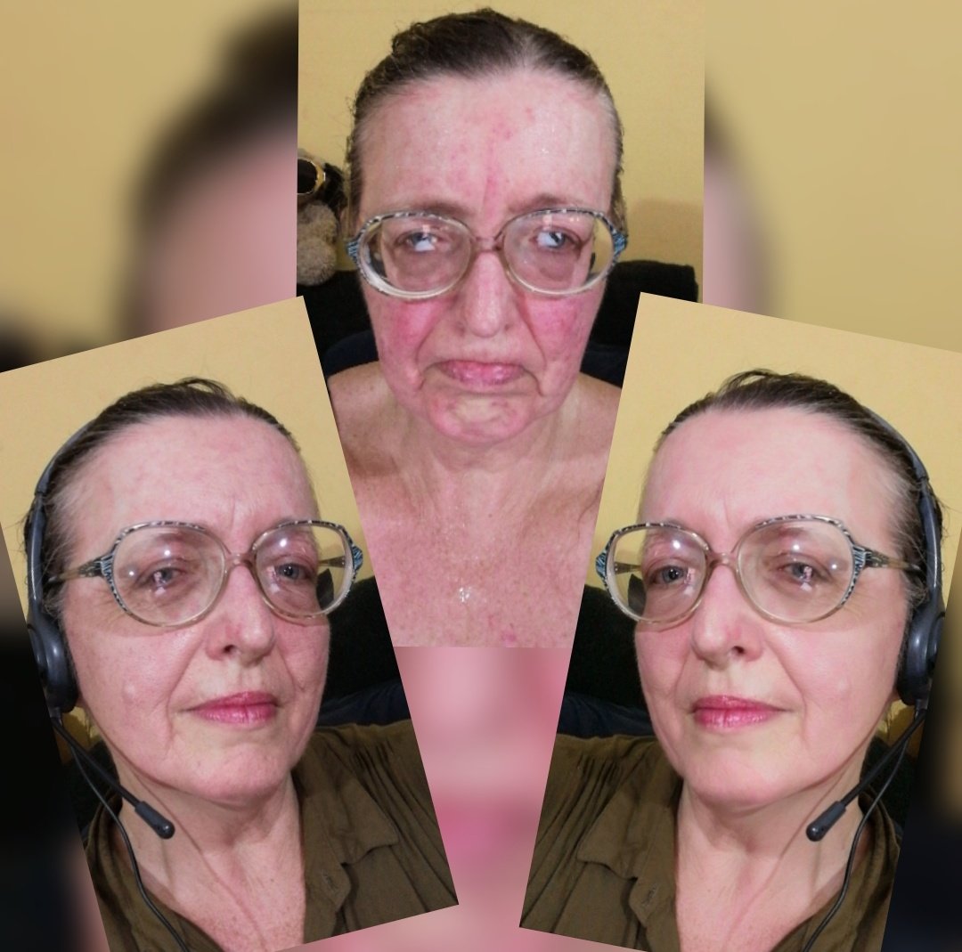 ladydebidebz1's tweet photo. Main pic: when not even a cool shower can fix this ugly face
Pic left: yay for blemish stick to cover most of the yuckiness
Pic right: how I wish I looked
#TooHotToday https://t.co/jioWDaSY53